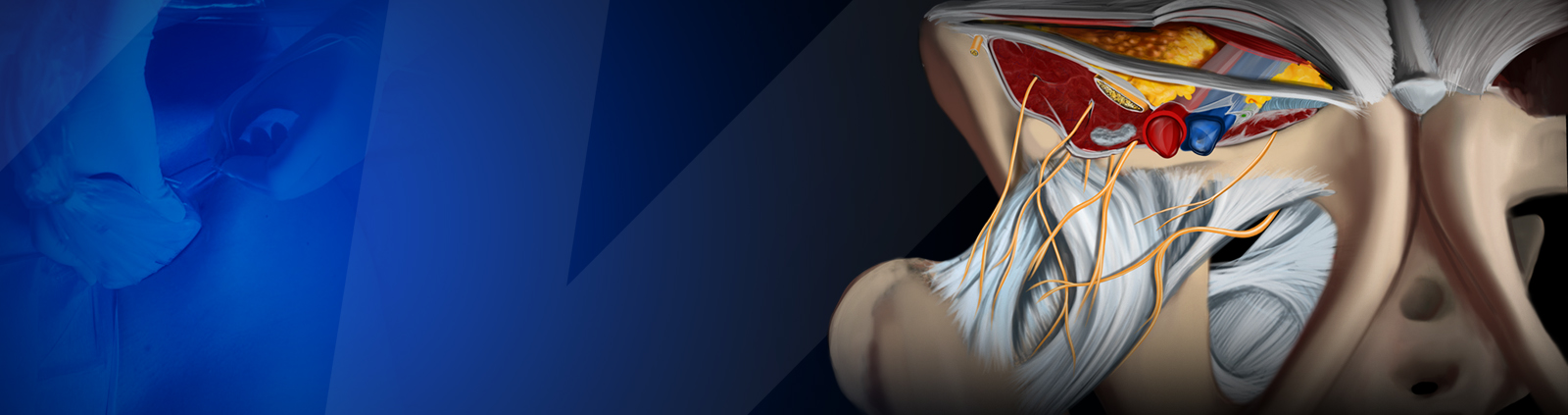 CME COURSE – Fascial Plane Blocks for Abdomen and Hip