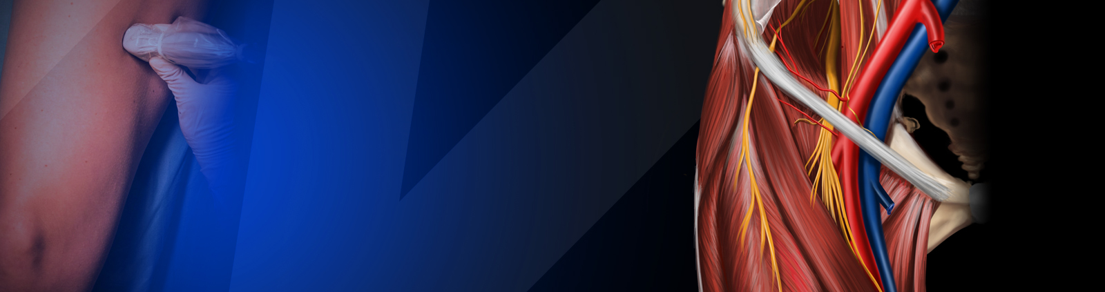 CME COURSE – Lower Extremity Blocks Part I