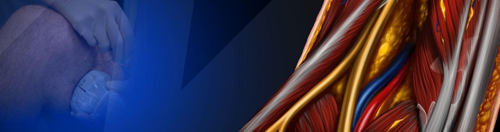 CME COURSE – Lower Extremity Blocks Part II