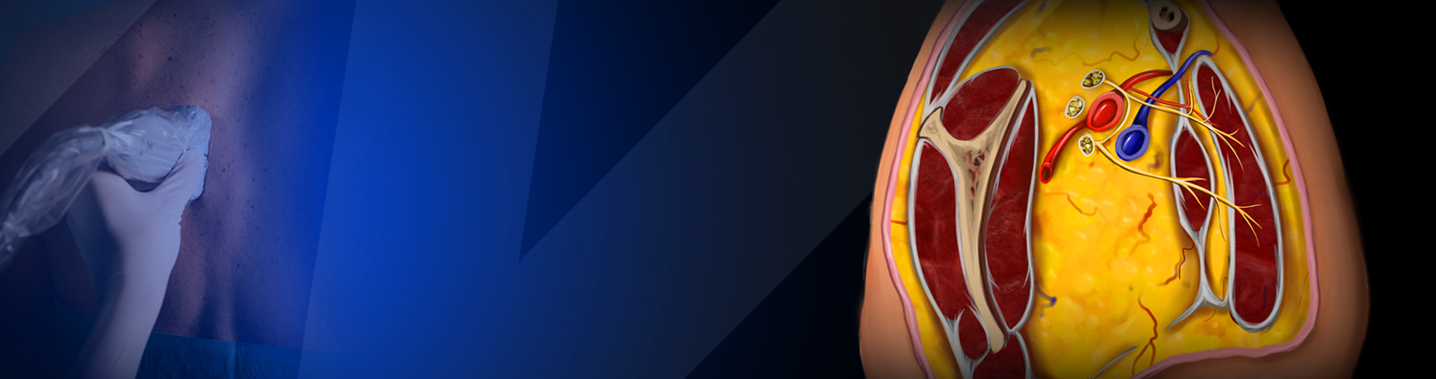 CME COURSE – Thoracic Fascial Plane Blocks