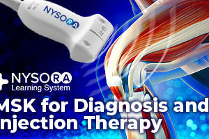 MSK Ultrasound for Knee Diagnostic